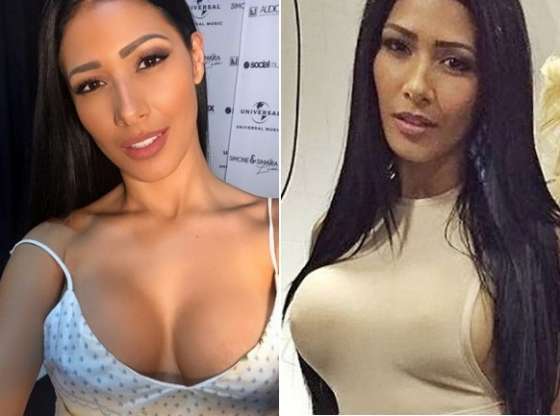 Silicone. Maioria da mulherada põe por estética