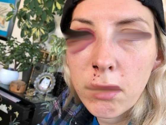 Tentou voltar, ouviu não, e socou a ex